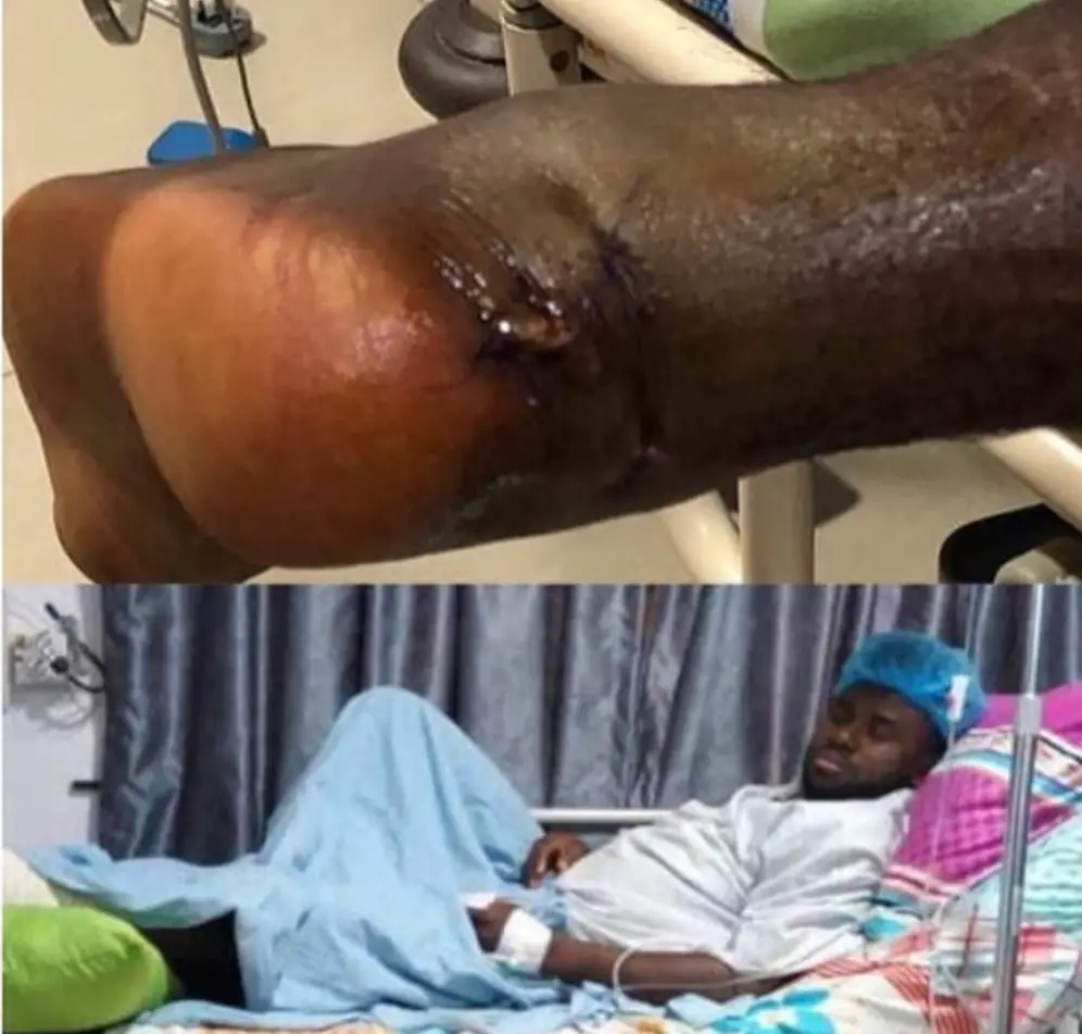 Onazi Doles Out N1.5m For Sani Emmanuel’s Surgery
