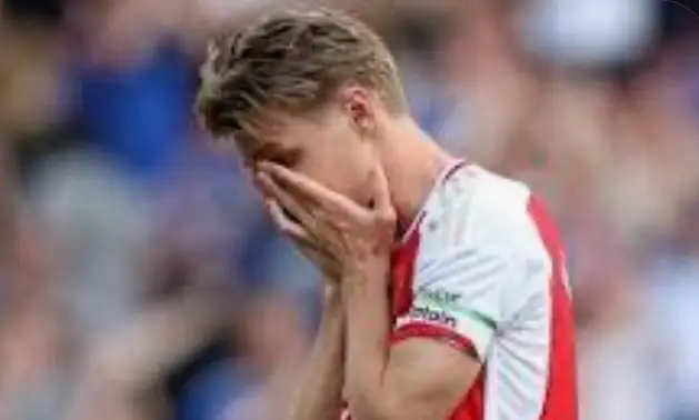 Arteta gir oppdatering om skadde Odegaard – Full Sport