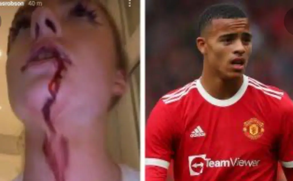 Girlfriend Accuses Man United Star Greenwood Of Physically Assaulting Her