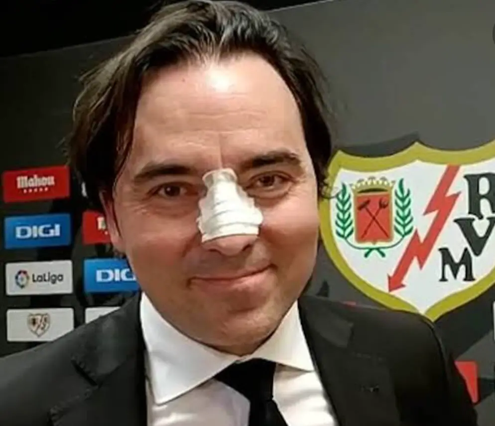 Presa Vallecano President Accuses Agent Of Headbutting Him